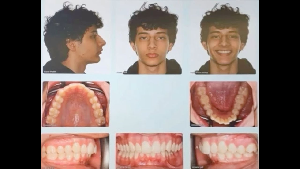 hamzah edit compilation!