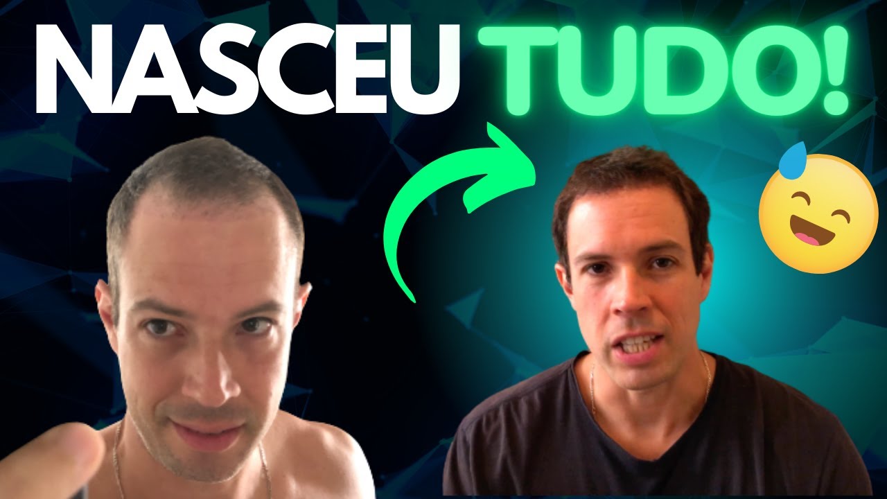 3 MESES APÓS UM TRANSPLANTE CAPILAR: COMO ESTOU? QUAIS OS CUIDADOS? Finanças Pessoais - Daniel Souza