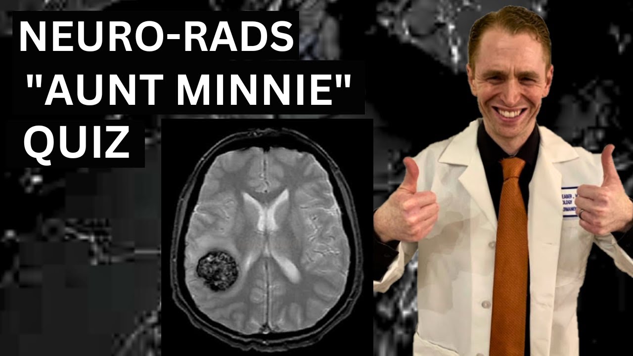Neuroradiology 