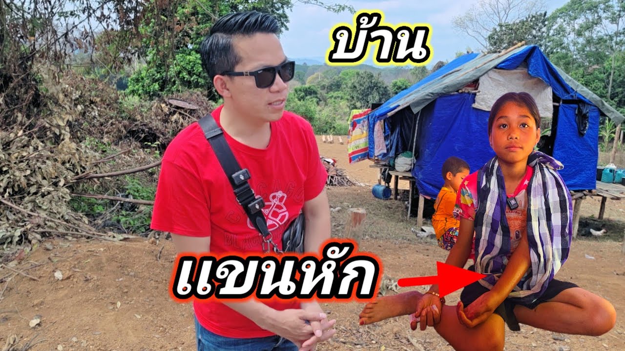 ล่าสุดแขนหักน้องจำปา ไม่มีเงินไปหาหมอ พ่อแม่ก็แยกทาง28 กุมภาพันธ์ ค.ศ. 2026