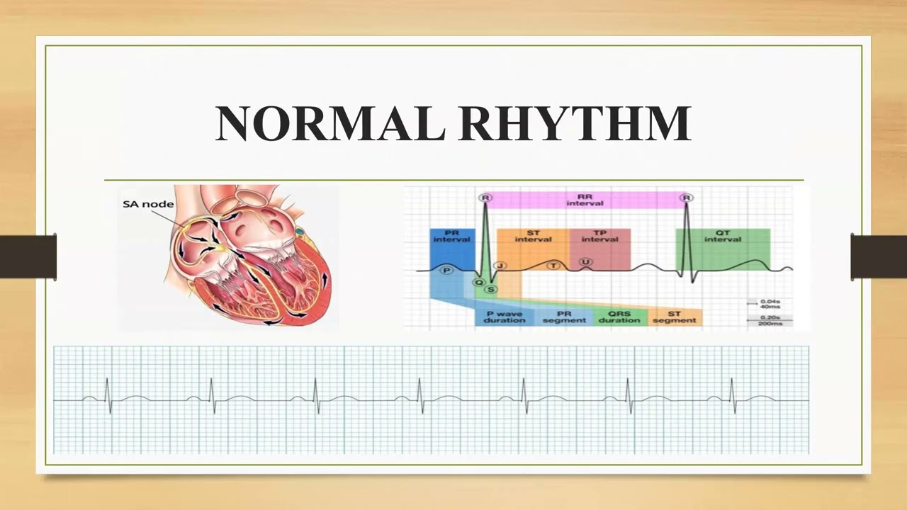 Series 2 PEDIATRIC ARRHYTHMIAS MUHAS Emory Pediatric Emergency Medicine Series March 2026 1