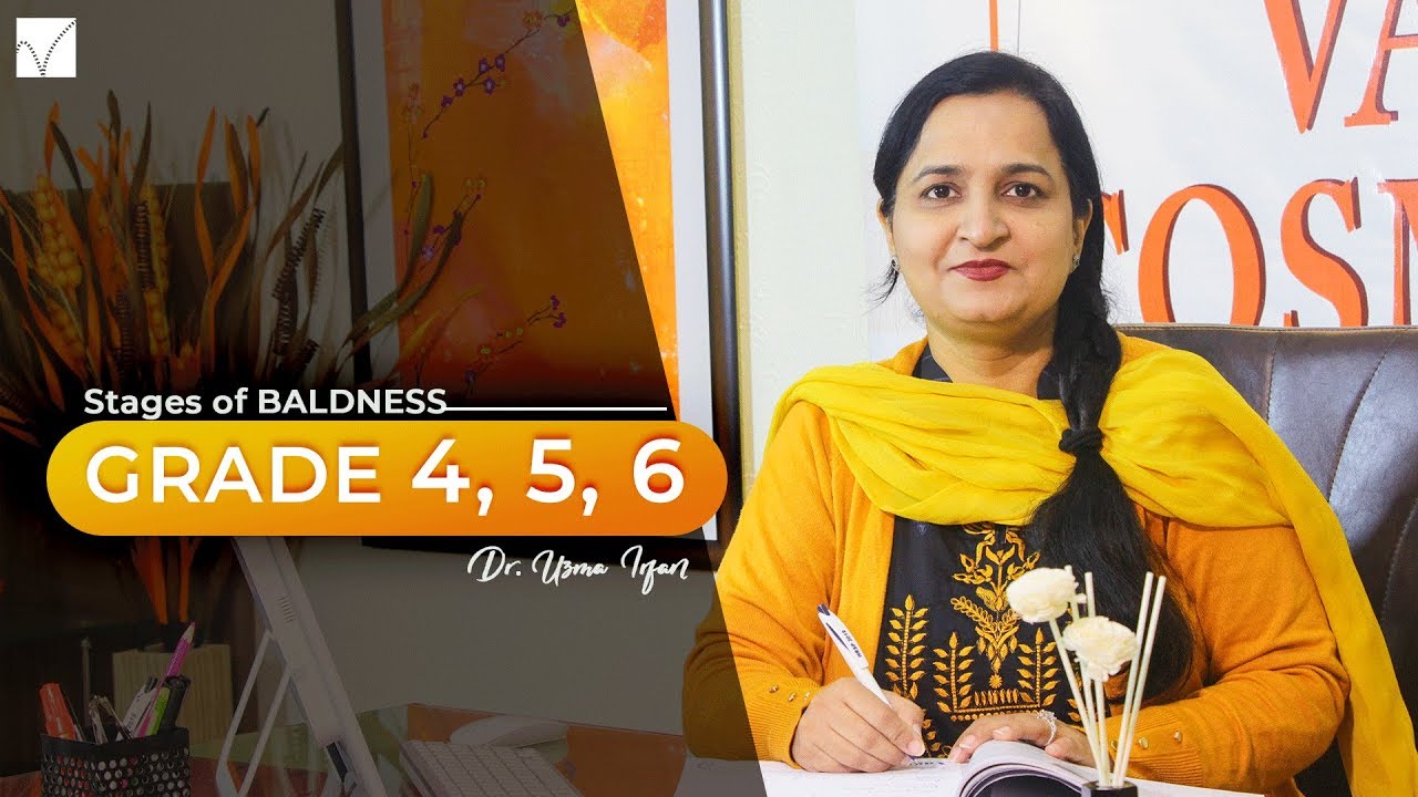 Stages Of Baldness Grade 4,5 &6| By Dr Uzma Irfan