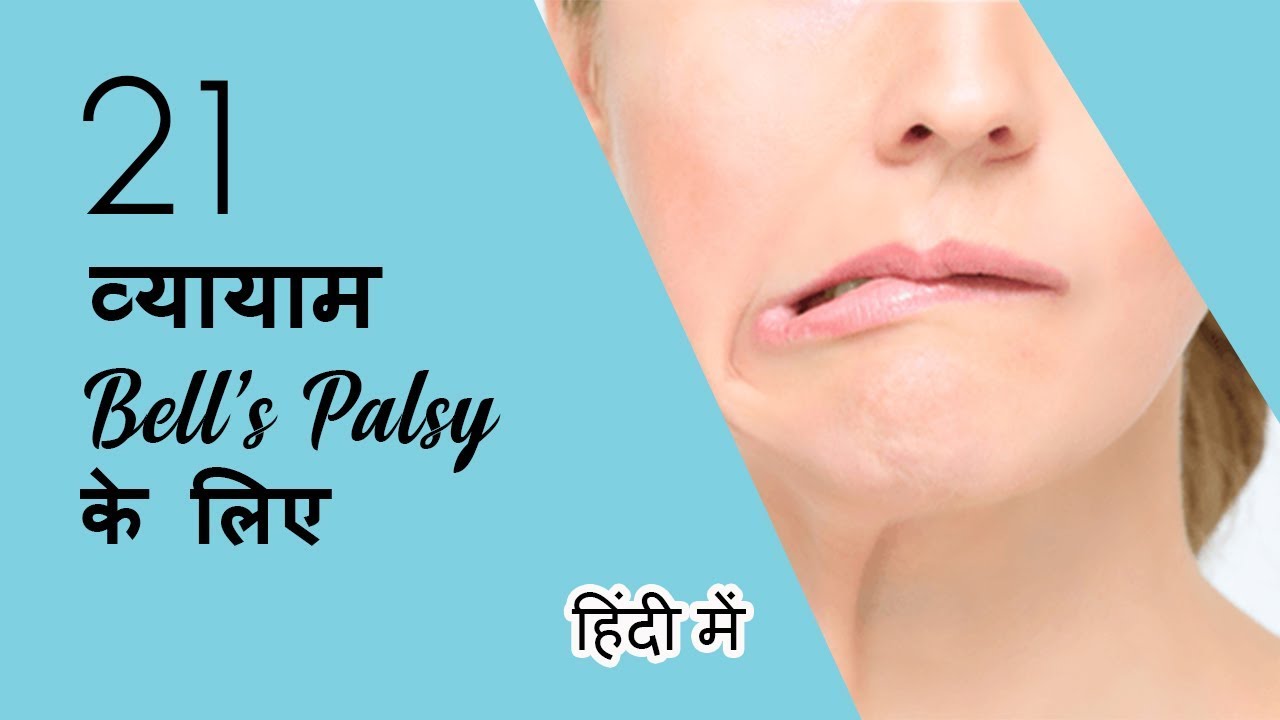 21 व्ययायाम BELL'S PALSY  के लिए