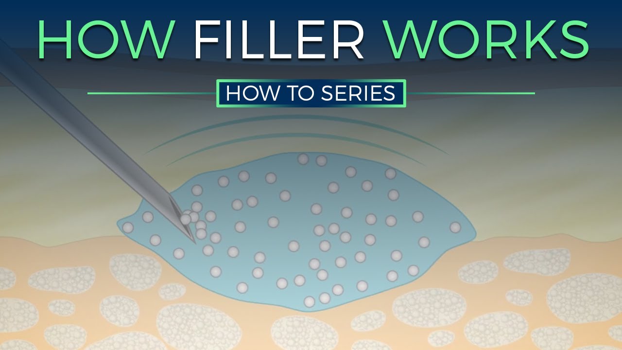 How Dermal Fillers Work - HOW TO SERIES