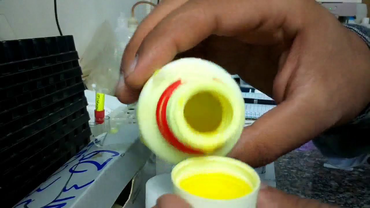 تحليل الكرياتينين(Creat) في الدم عملي