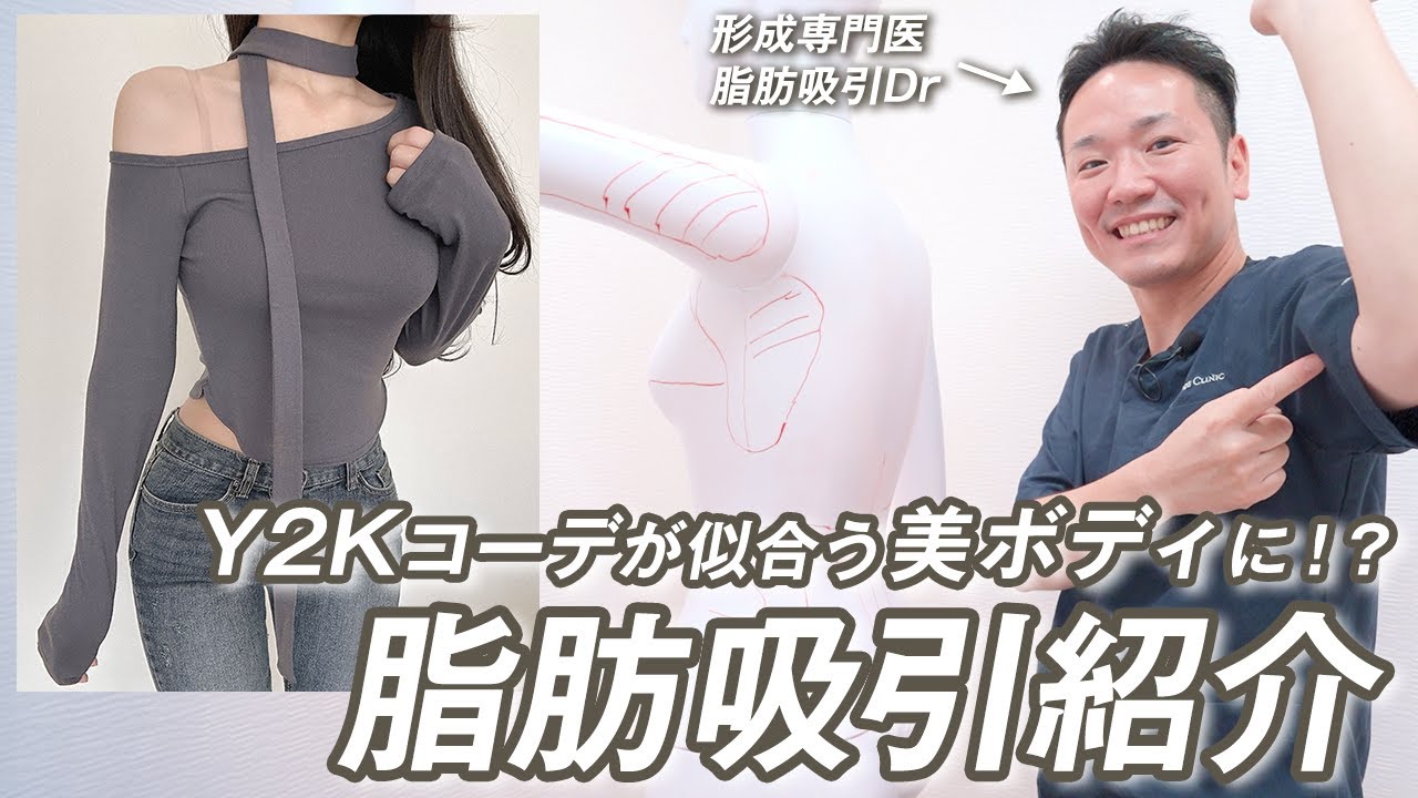 【骨格ストレート】ストレートさんあるある…😢タイトなトップスを着た時の二の腕、お腹のむちむち感が気になる原因を解説！最強のくびれボディになれる脂肪吸引を紹介！💁🏻‍♀️【モッズクリニック】