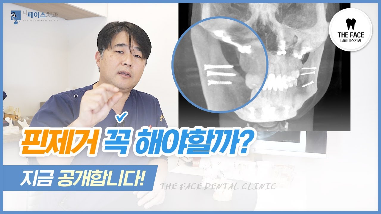 양악 후 핀제거 꼭 해야할까? 핀제거의 모든 것 공개합니다!