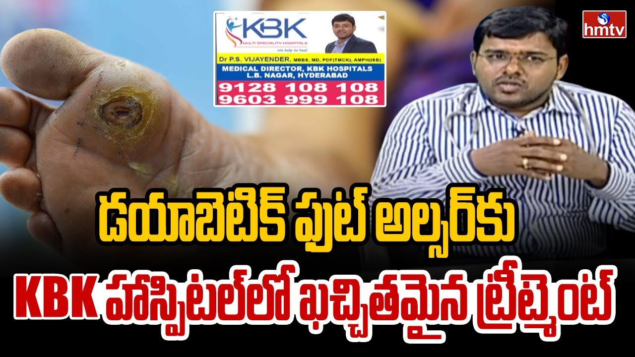 KBK Hospital Dr Vijayender Advices about Diabetic Foot Ulcer | Jeevana Rekha | hmtv