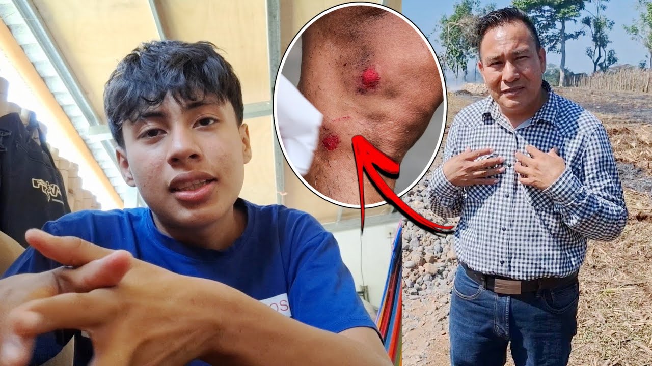 (UN ACCIDENTE)🚨CASI ME MANDA AL HOSPITAL⁉️Mi papá se asustó al verme así.