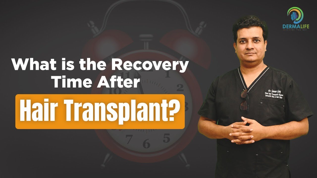 What is the Recovery Time After Hair Transplant? | Best Hair Transplant Clinic in Delhi