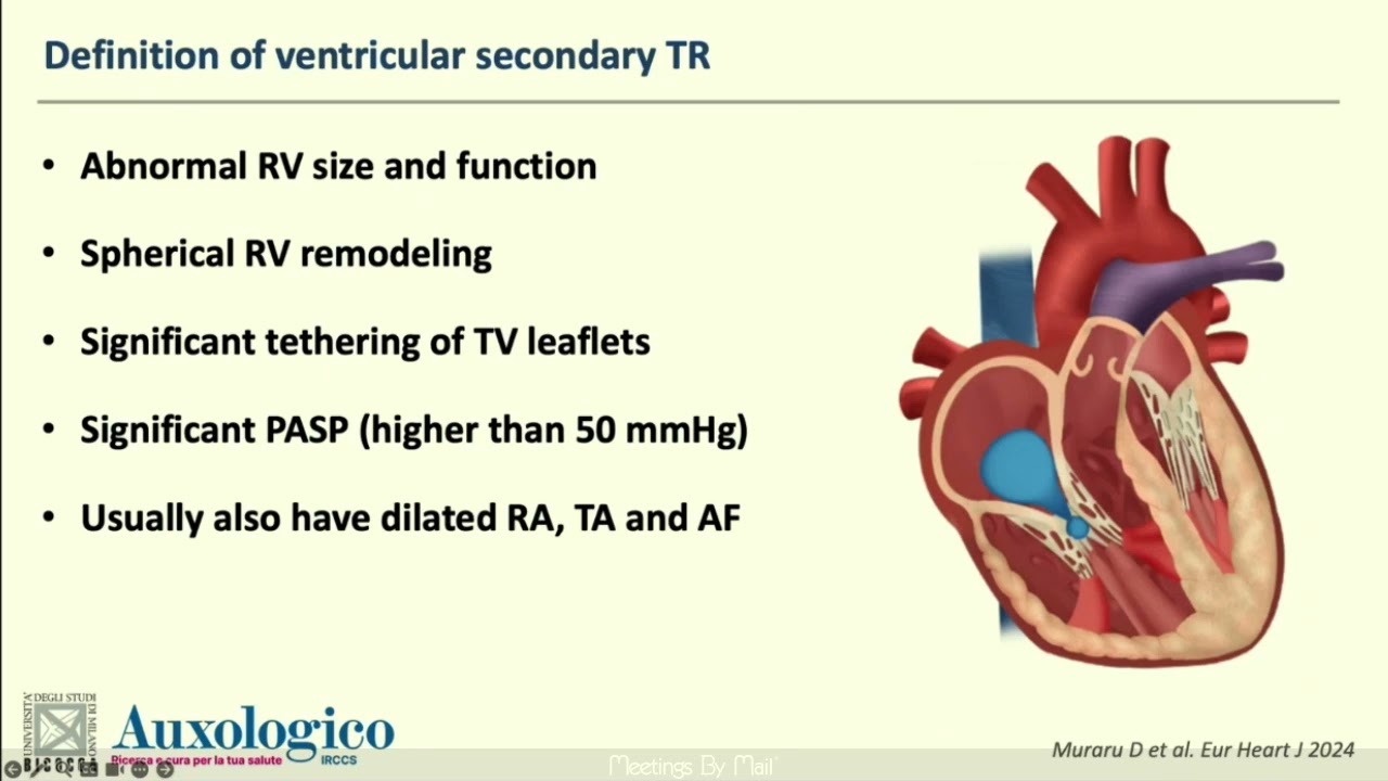 Расширенная трансторакальная эхокардиографическая оценка заболеваний трикуспидального клапана и п...