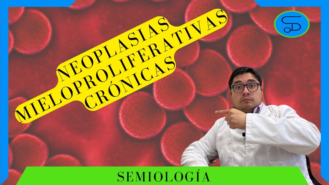 Neoplasia mieloproliferativa crónica, resumen actualizado👨‍⚕️Dr Semio