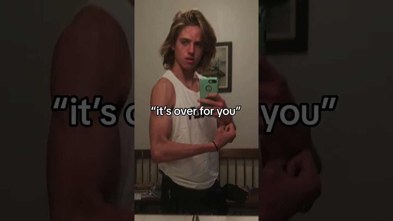 It wasn&rsquo;t over&hellip; #follow #acne #skincare #transformation #model #viral #trending #explore #reels