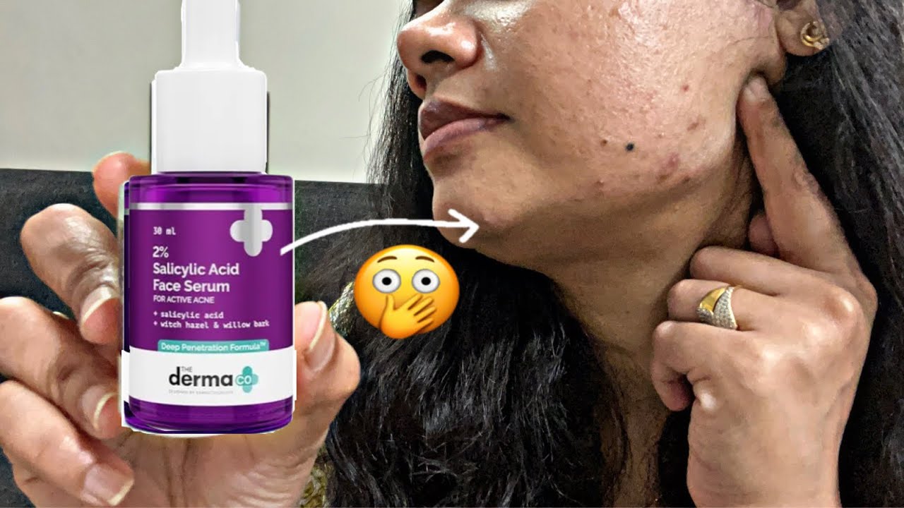 This Happened when I used this Face Serum | Derma Co Salicylic Acid Face Serum Honest Review