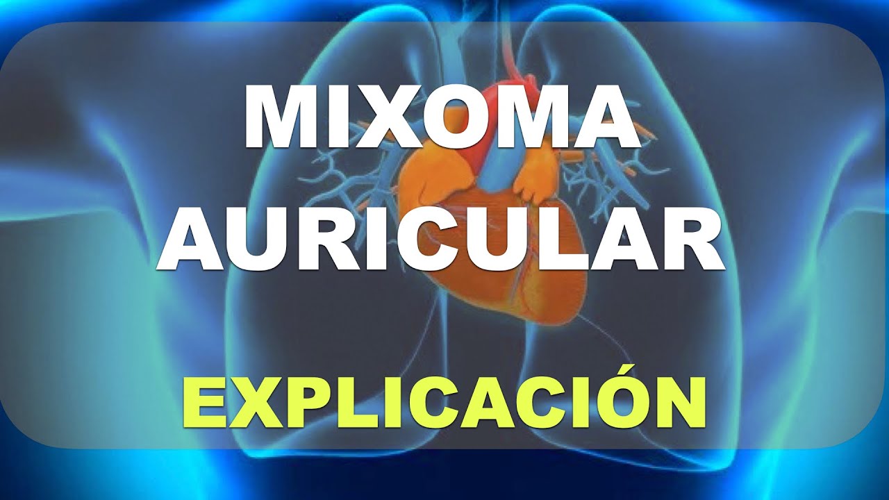 Qué es el Mixoma Auricular