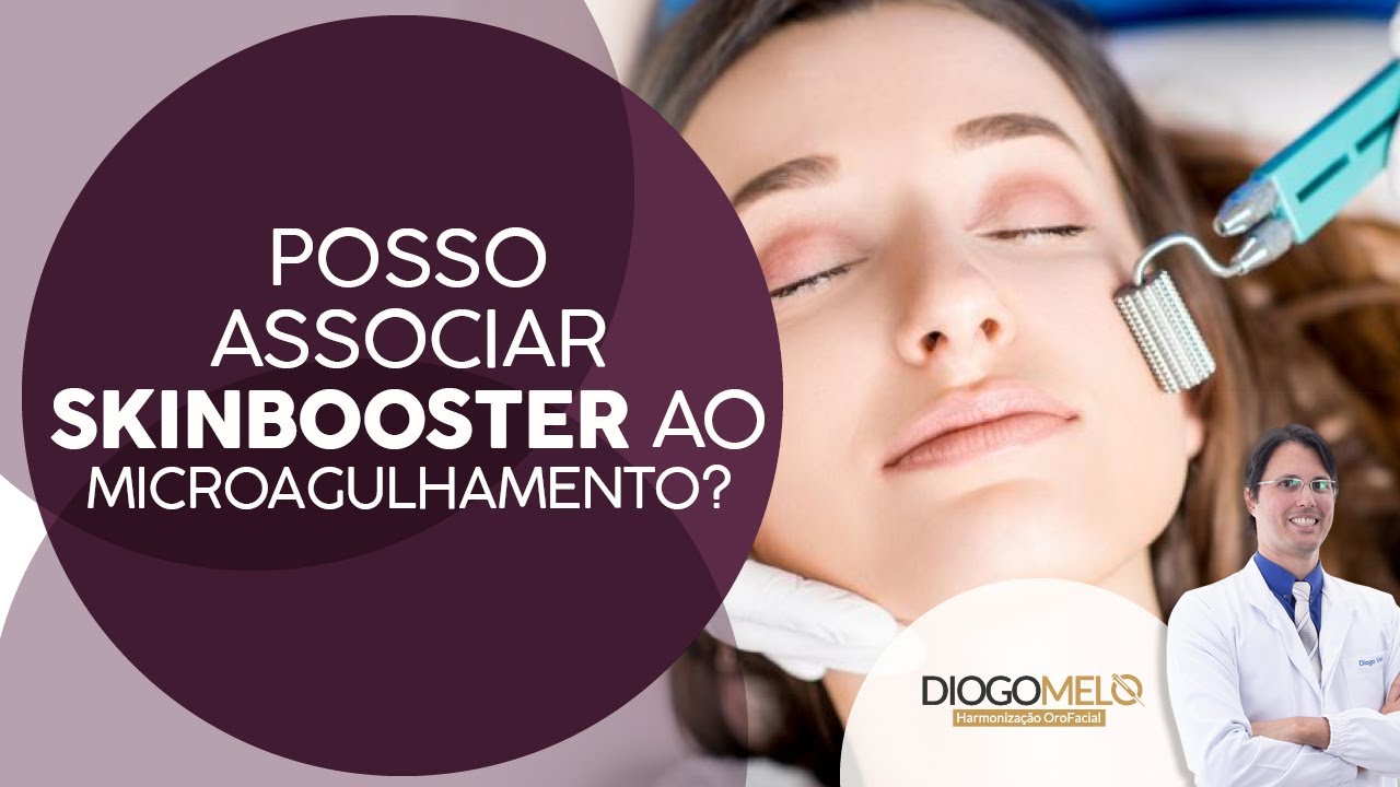 Posso associar Skinbooster ao Microagulhamento?