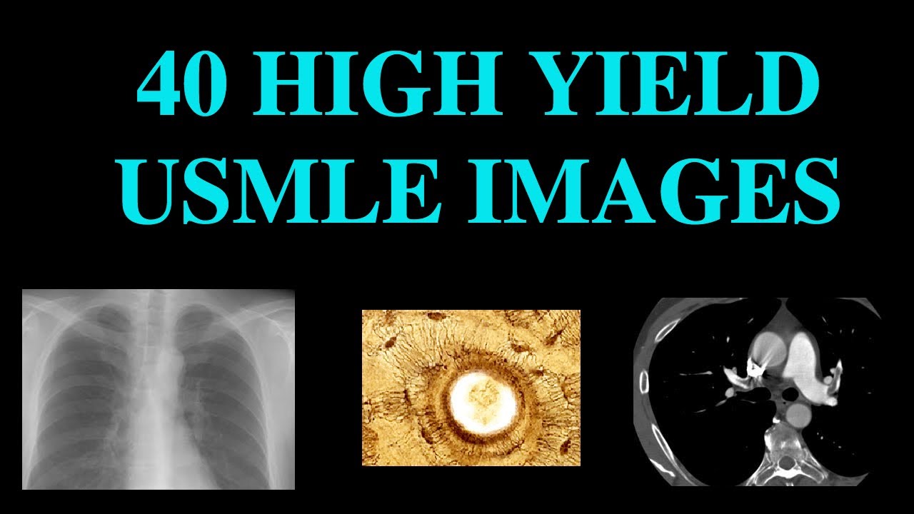 40 High Yield Images for USMLE (CT, XRay, Histology)