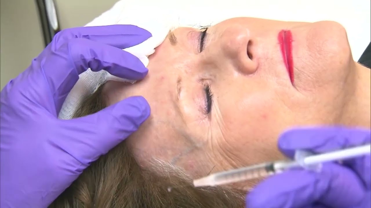 Cơ quan FDA cảnh b&aacute;o c&aacute;c c&ocirc;ng ty về việc quảng c&aacute;o bất hợp ph&aacute;p c&aacute;c phi&ecirc;n bản Botox chưa được ph&ecirc; du