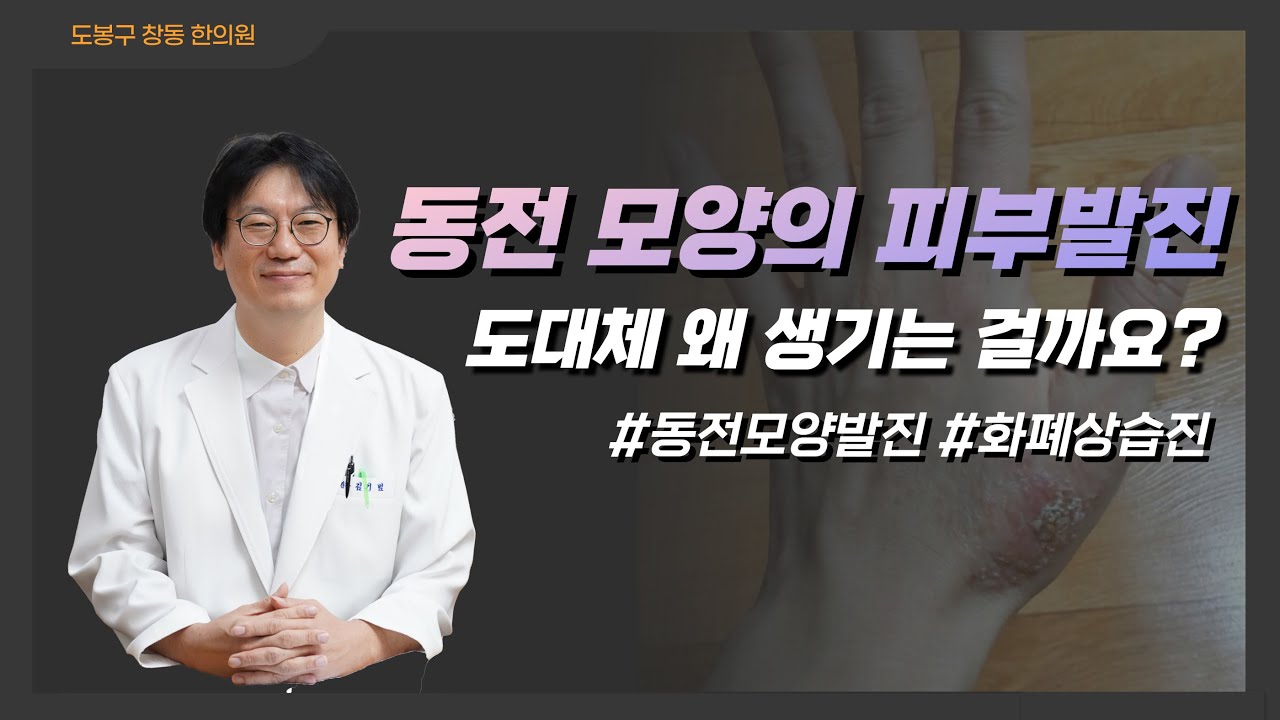 동전모양발진, 화폐상습진 이런 분들이 잘 걸립니다.