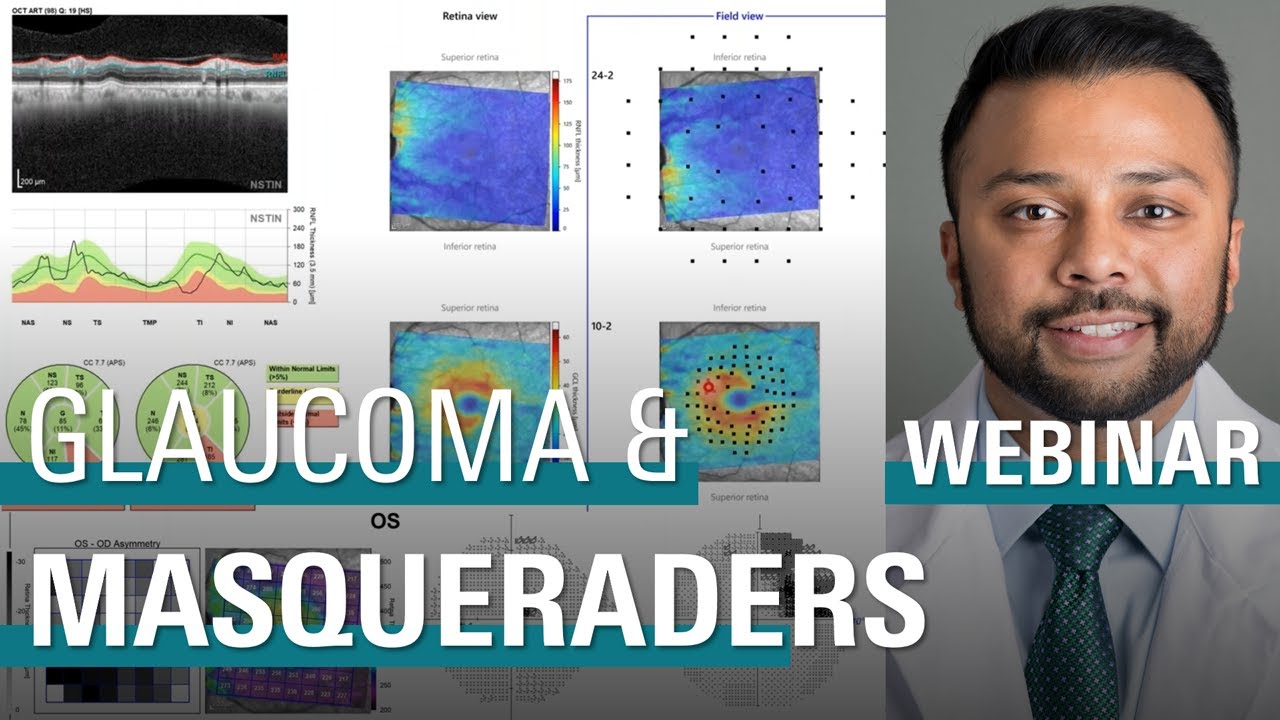 Glaucoma and SPECTRALIS SD-OCT – Diagnosis, Masqueraders, and Clinical Pearls | SPECTRALIS