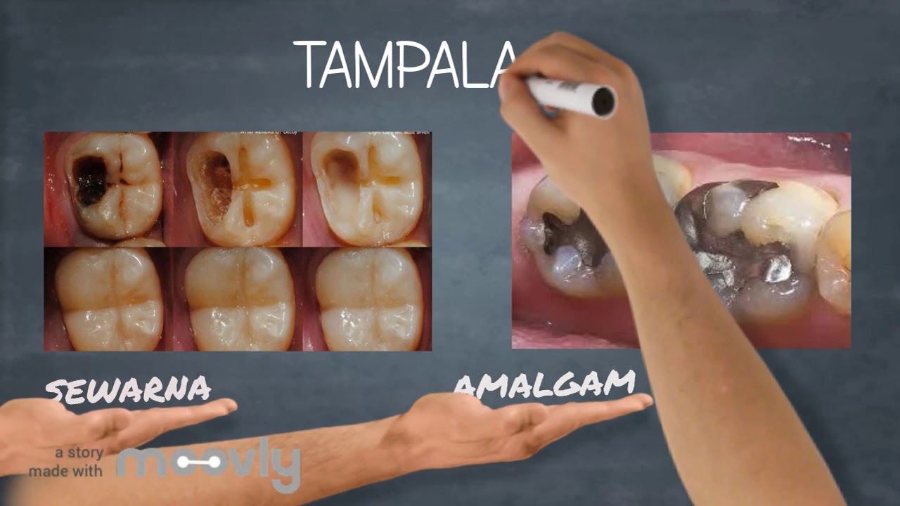 jenis rawatan pergigian
