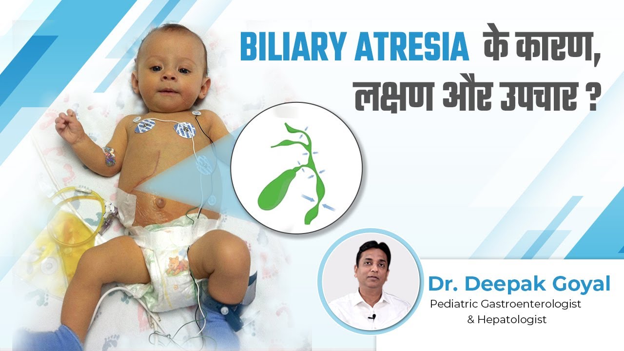 Biliary Atresia के कारण, लक्षण और उपचार? | Dr. Deepak Goyal