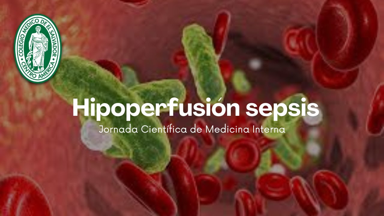 Hipoperfusión Sepsis