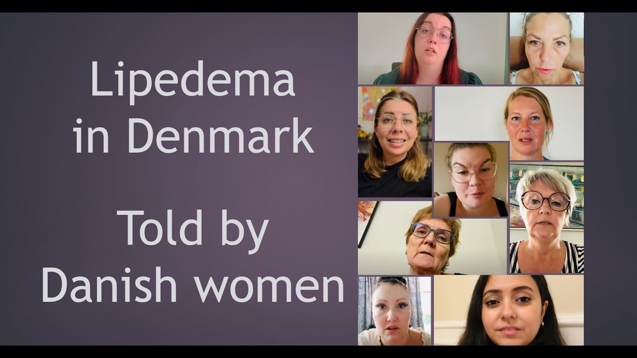 Lipedema in Denmark, told by Danish women (EN subtitles)