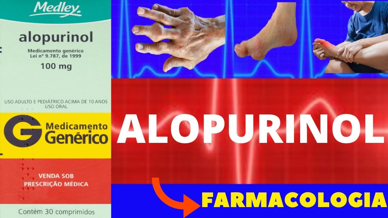 ALOPURINOL - PARA QUE SERVE, COMO TOMAR, COMO FUNCIONA, EFEITOS COLATERAIS - REMÉDIO PARA GOTA