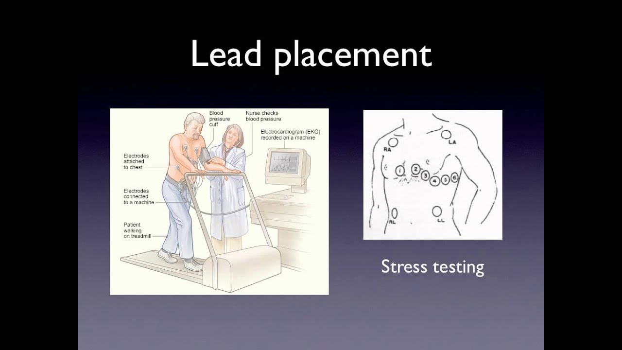 Patient Care section of the NHA EKG Tech exam