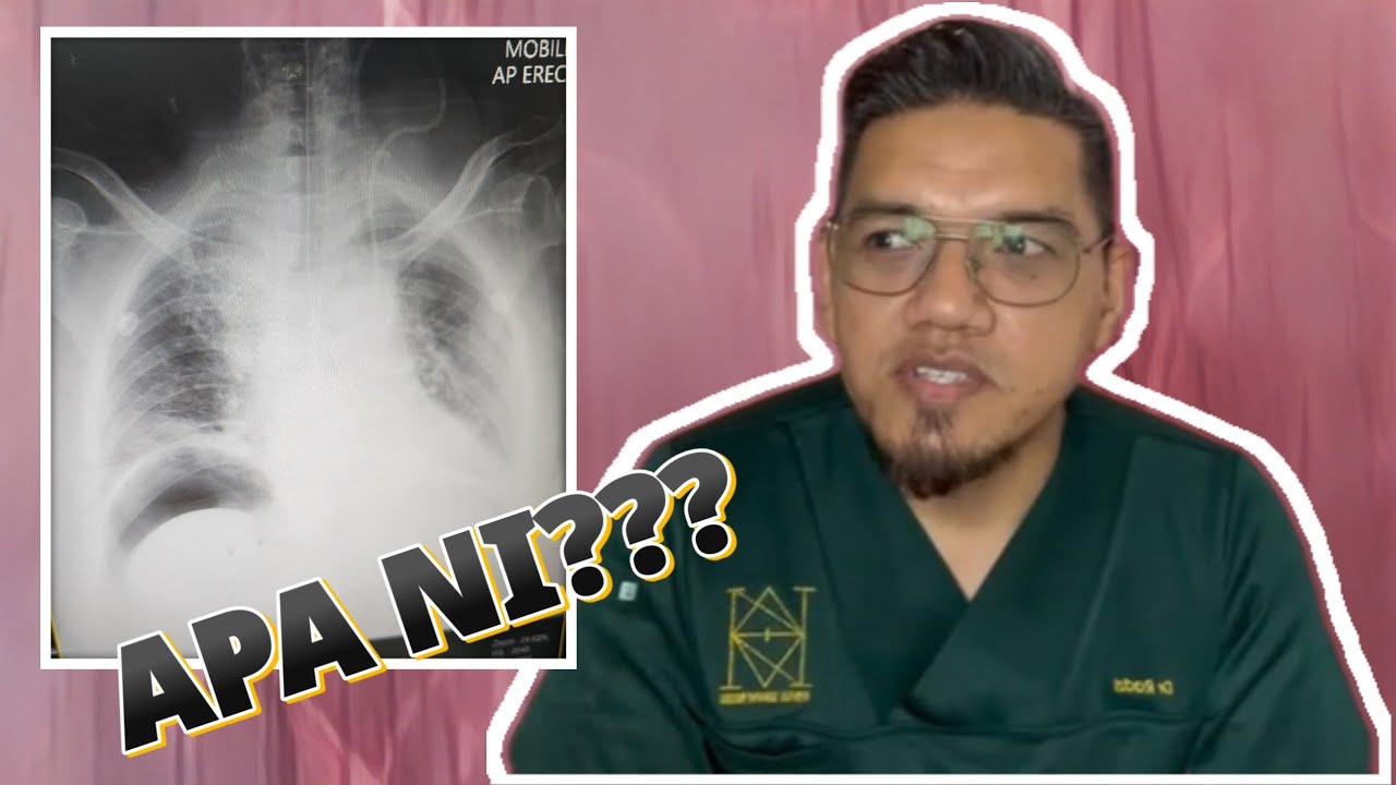 Jangan Sampai Usus Bocor!!! DRFRADZI cerita tentang 