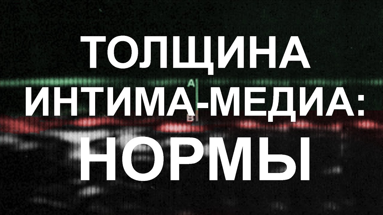 Интима-медиа: норма