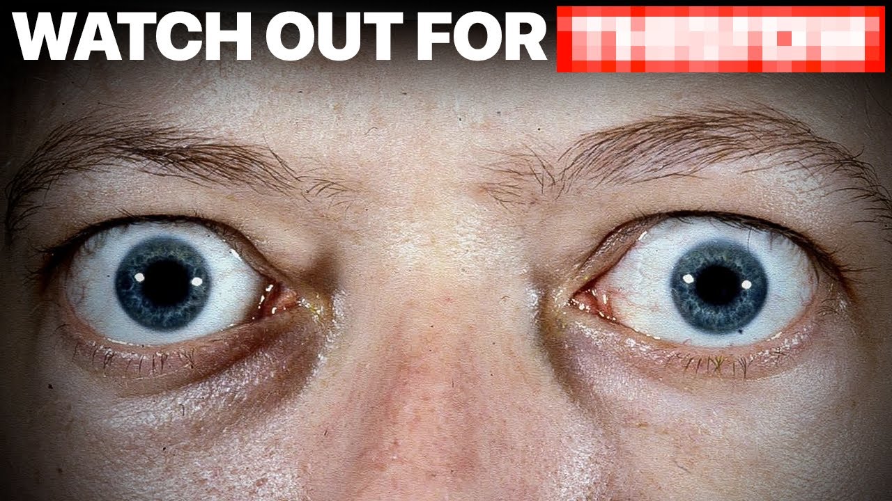 What Are Symptoms of Graves' Disease?