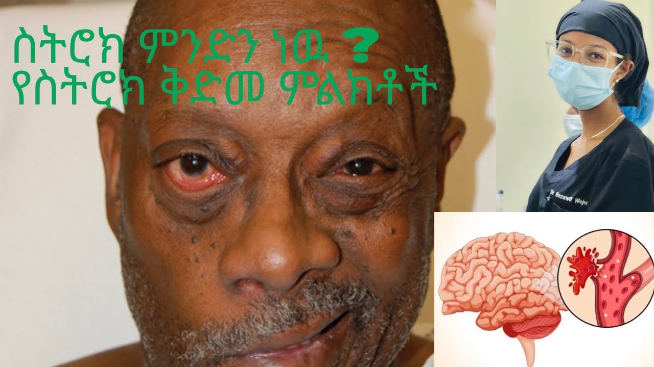 የስትሮክ መንስኤዋች እና ህክምናዉ (causes of stroke & treatment)