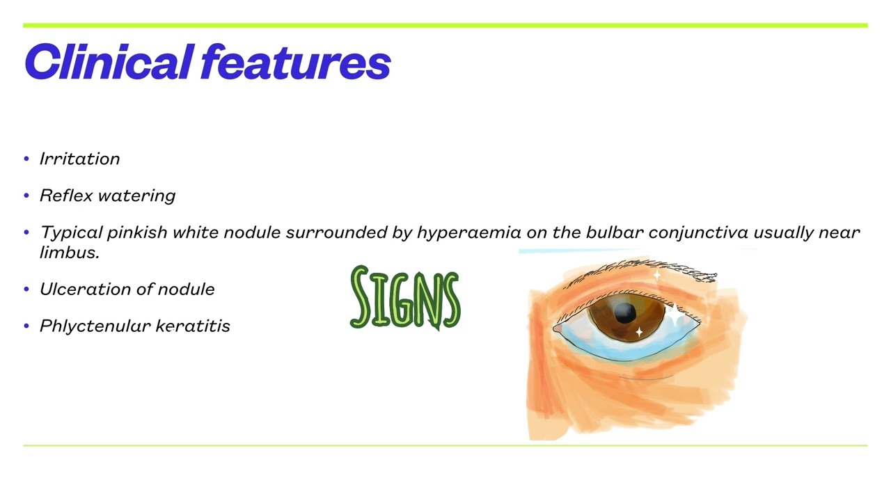 Let’s learn phlyctenular keratoconjunctivitis 