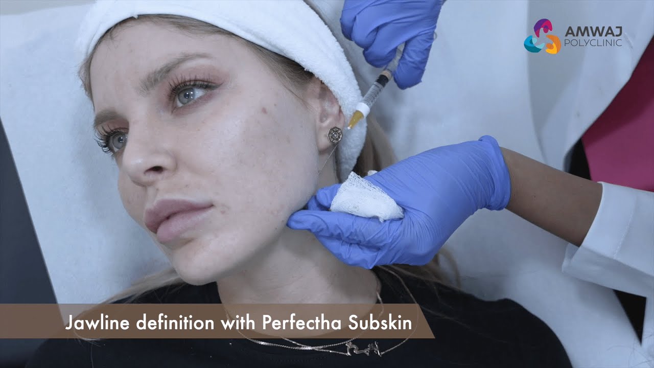 Jawline Transformation | Achieving Definition and Reversing Lip Filler Migration