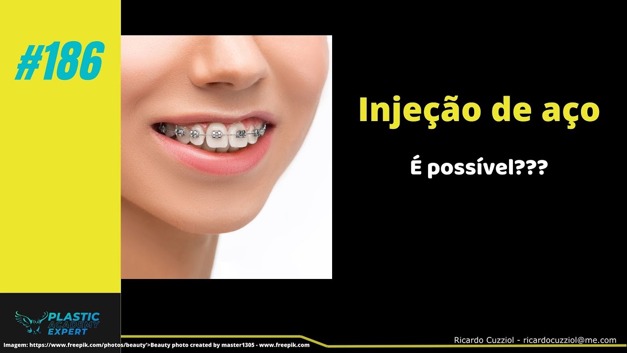 #186 - Metal Injection Molding - MIM