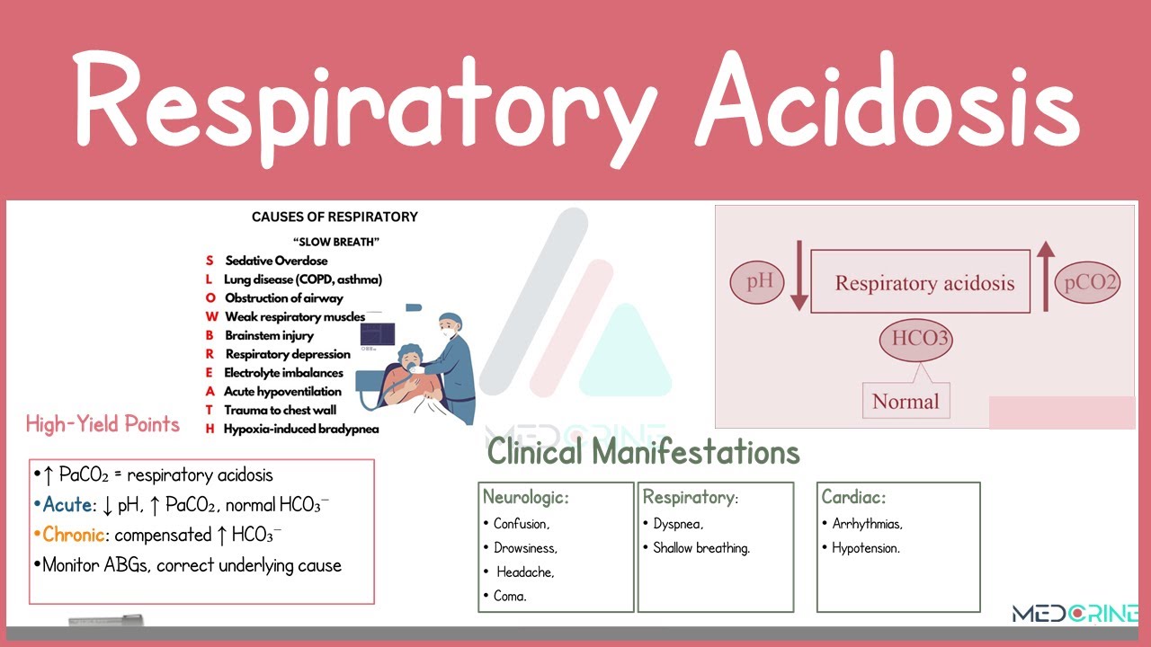 Respiratory Acidosis | Pathophysiology, Causes, ABG, & Treatment Explained