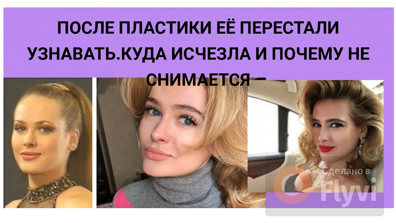 АННА ГОРШКОВА - ПОСЛЕ ПЛАСТИКИ ЕЁ ПЕРЕСТАЛИ УЗНАВАТЬ - КУДА ИСЧЕЗЛА И ПОЧЕМУ НЕ СНИМАЕТСЯ