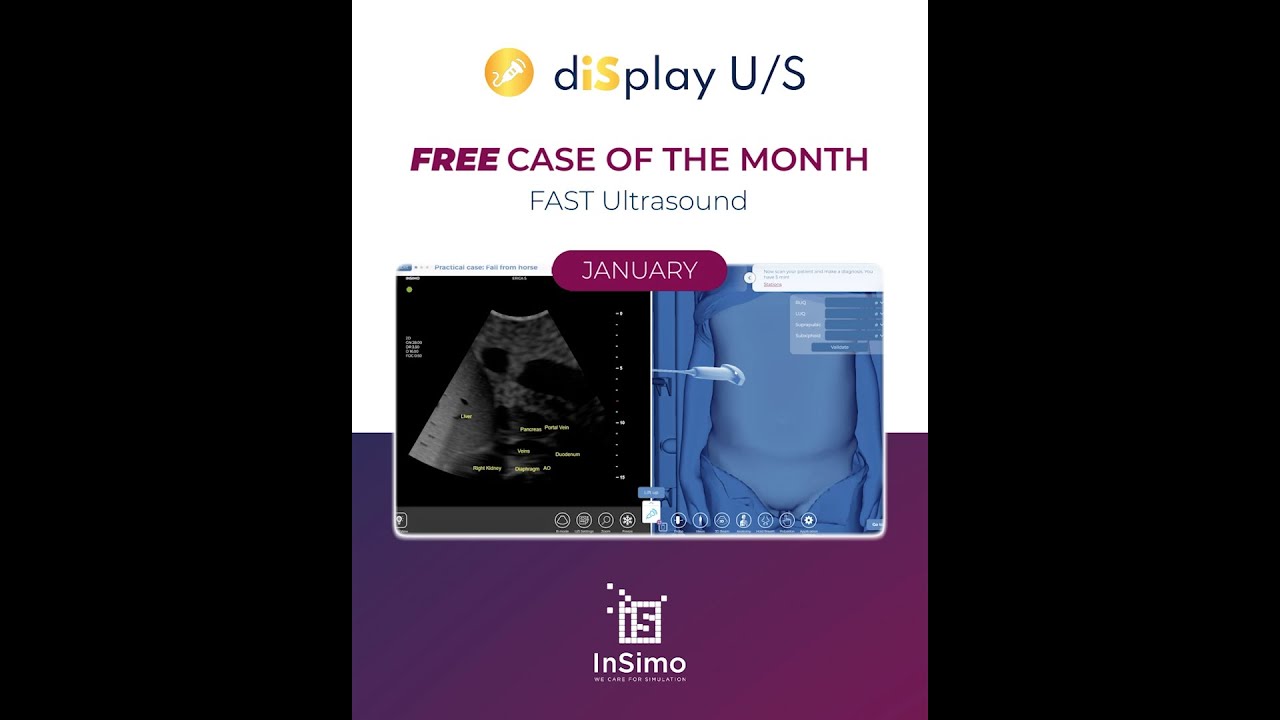 January 2026 - FAST Ultrasound: Horse riding fall