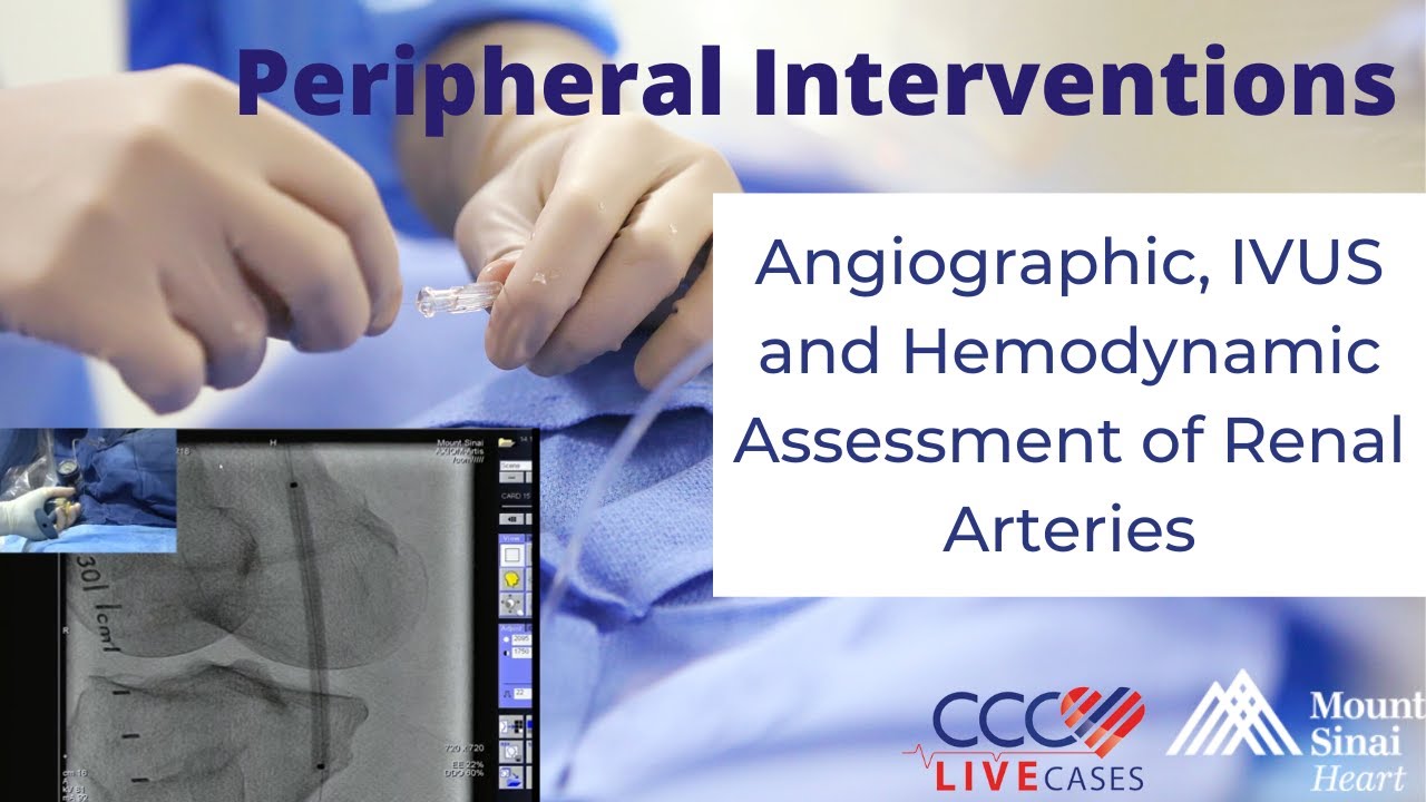 Angiographic, IVUS and Hemodynamic Assessment of Renal Arteries - December 17, 2014 Live Case Video