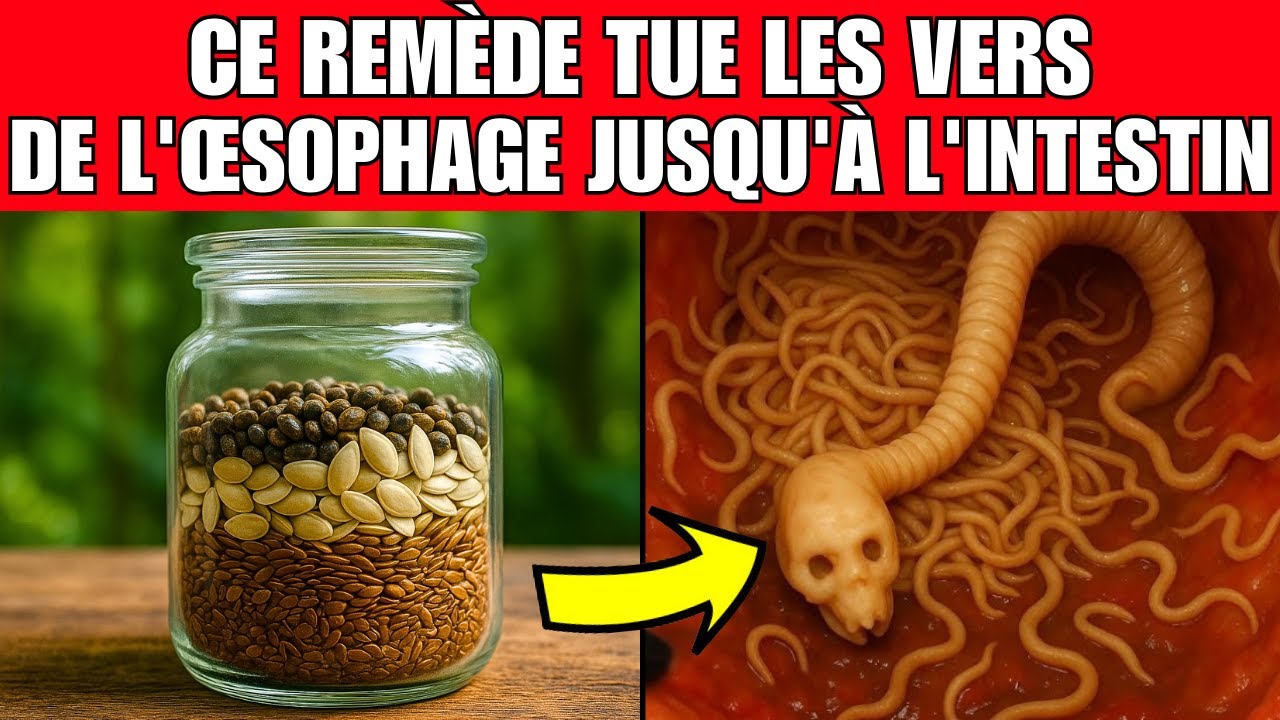&Eacute;LIMINEZ les VERS - 5 rem&egrave;des naturels qui d&eacute;truisent les parasites intestinaux