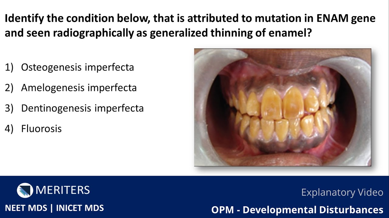 NEET MDS | INICET - OPM -Developmental Disturbances | Explanatory Video | MERITERS