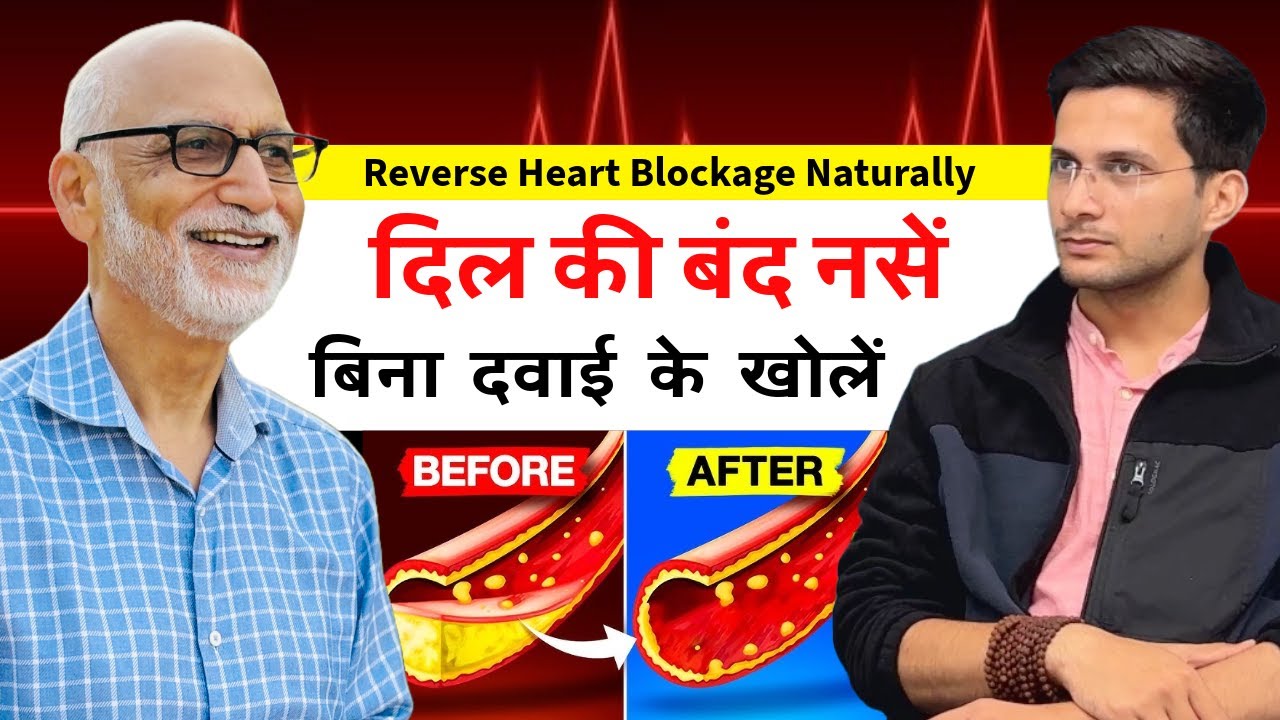 Reverse Heart Blockage Naturally Ft. Dr. Susheel Sharma | Unclog Arteries | Himanshu Bhatt