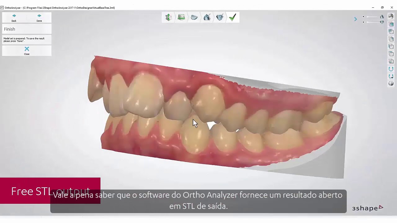3Shape Ortho Analyzer - Introdução as soluções em Ortodontia da 3Shape