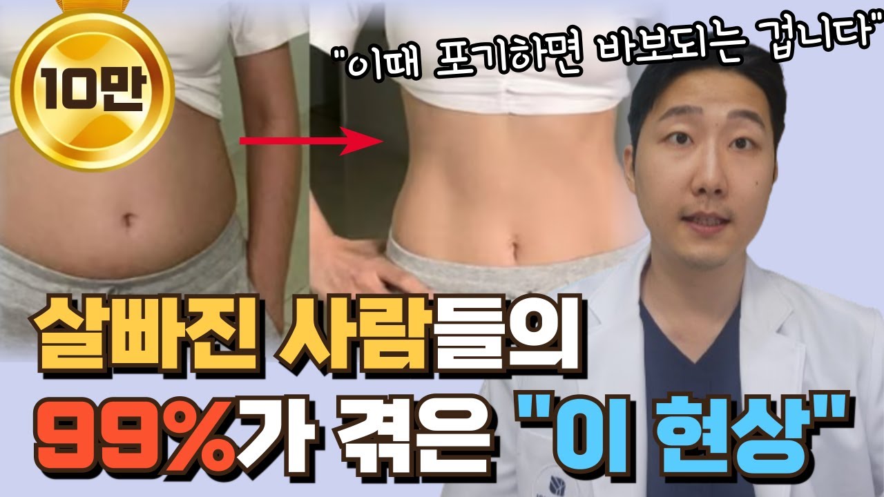 진짜 살빠질 때 오는 신호, 모르면 손해입니다 ㅣ 다이어트, 살빼는법