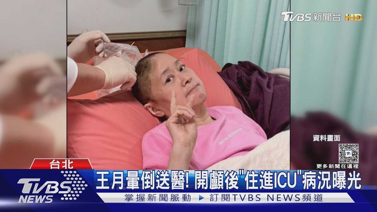 王月暈倒送醫! 開顱拿血塊「ICU昏迷5天」本周顱骨復原手術｜TVBS新聞 @TVBSNEWS01