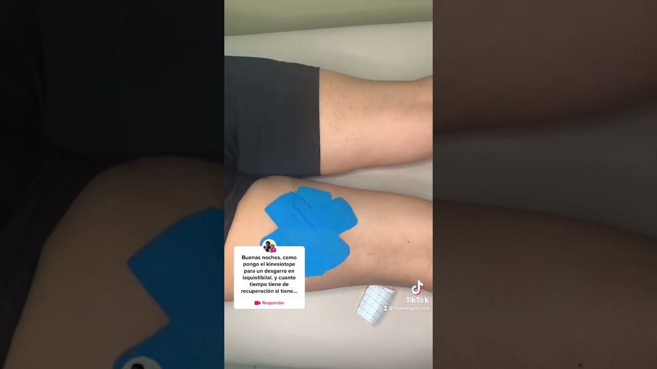 kinesiotape para un desgarro en isquiotibiales