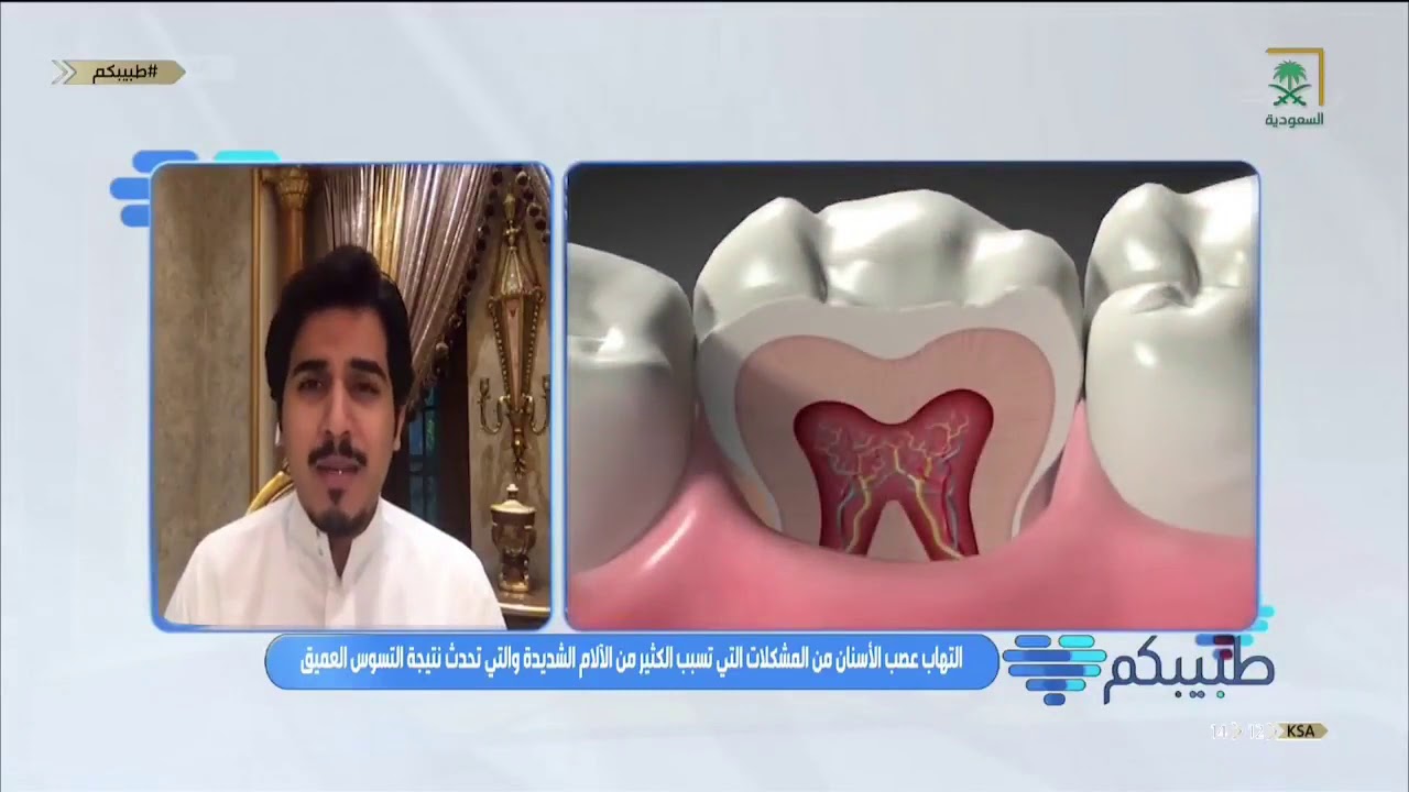 #طبيبكم | أعراض التهاب عصب الأسنان  مع د. عبدالمجيد آل شجاع - أخصائي علاج الجذور والأعصاب