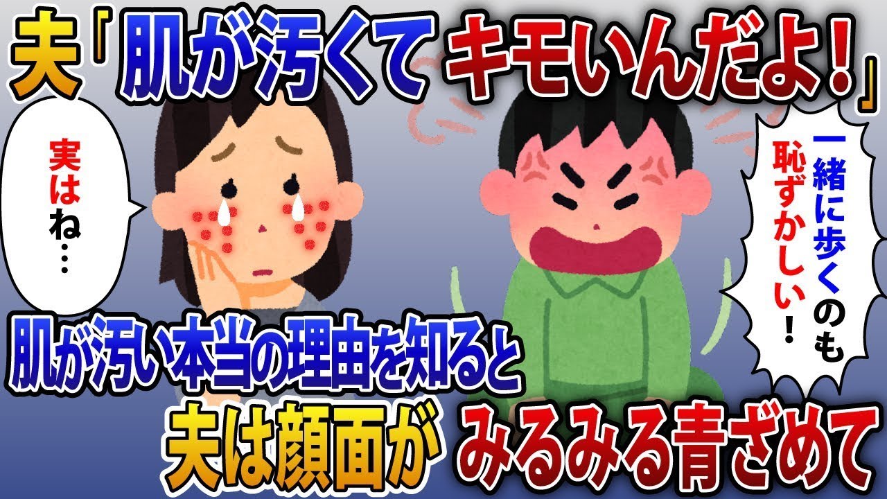 夫からの暴言で苦しんでいた私。私の肌が汚い理由を知った夫は驚愕し、顔面蒼白になった。